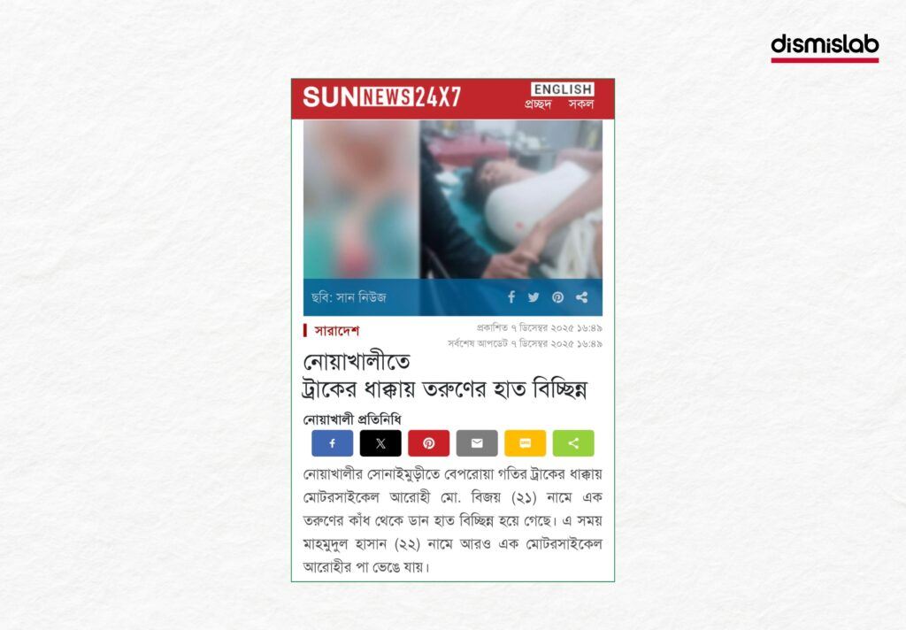 Fact-check image showing a Chhatra League worker’s hand being cut off in political rivalry
