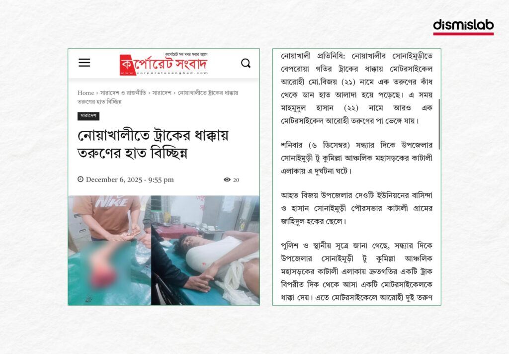 Fact-check image showing a Chhatra League worker’s hand being cut off in political rivalry