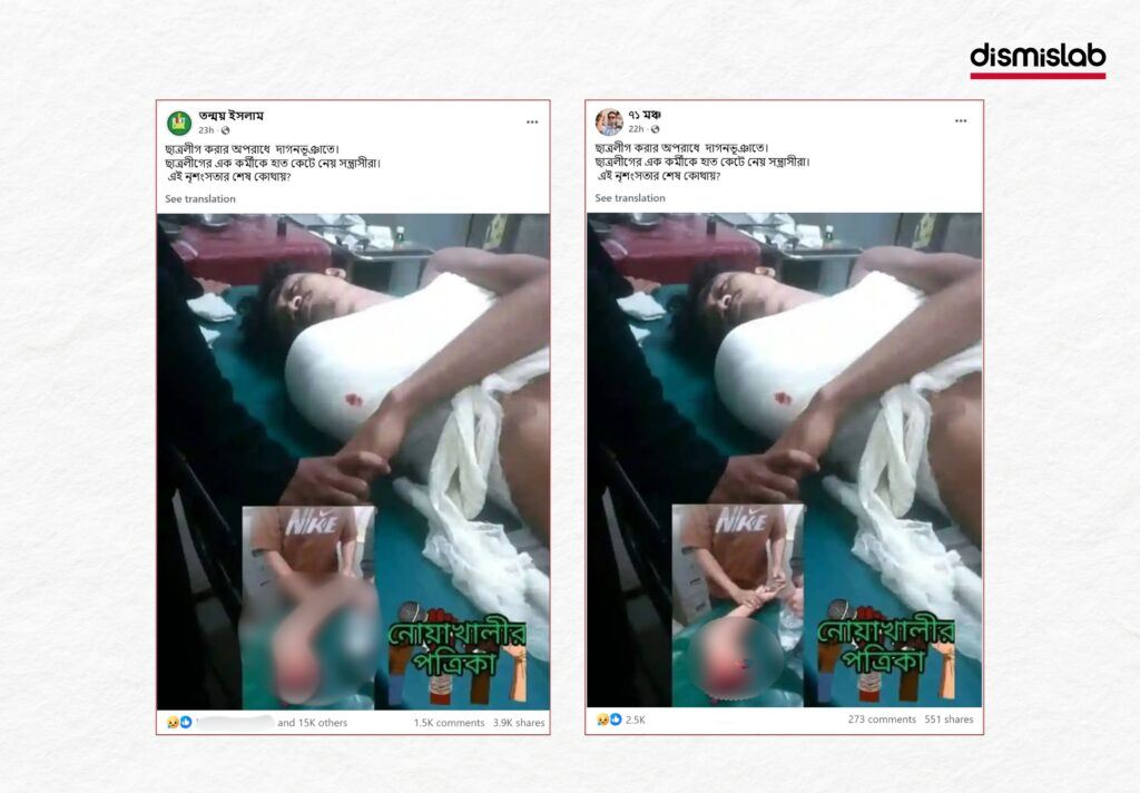 Fact-check image showing a Chhatra League worker’s hand being cut off in political rivalry