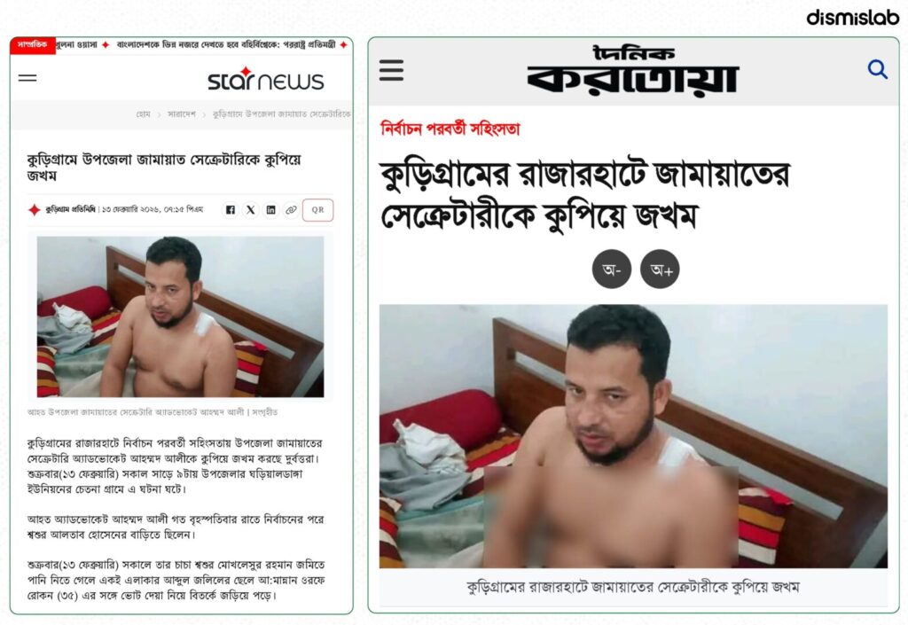 Fact-check of a Facebook photo falsely claiming Jamaat-e-Islami activists attacked a BNP leader in Rajarhat, Kurigram