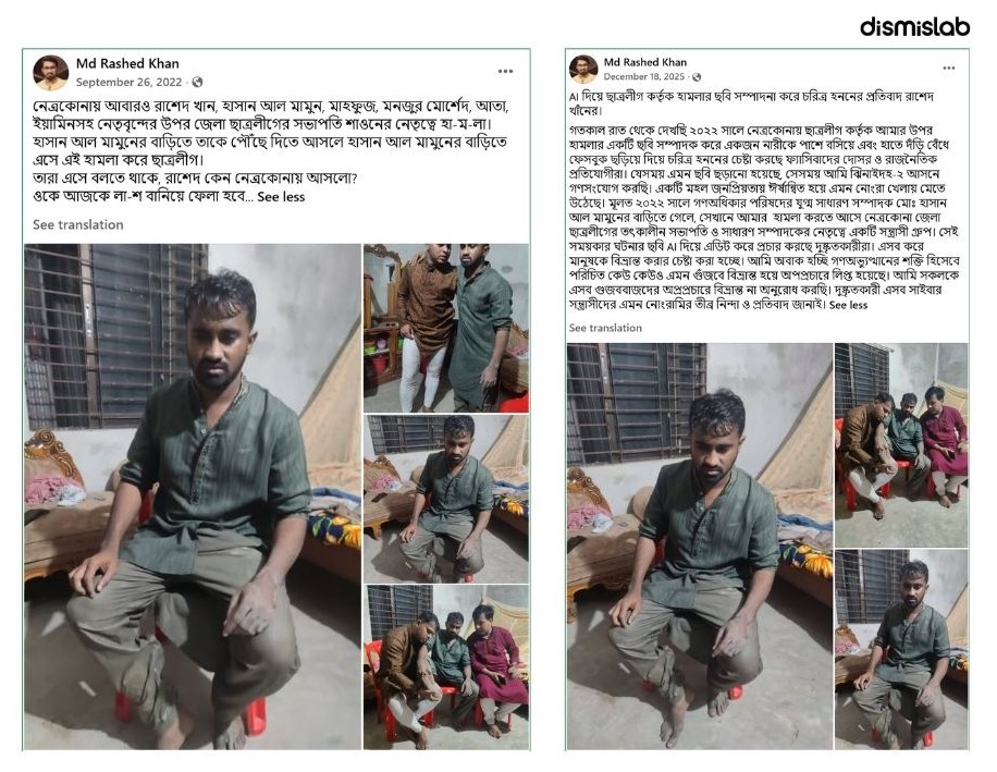 BNP assaulted Rashed Khan, Chhatra League beat
