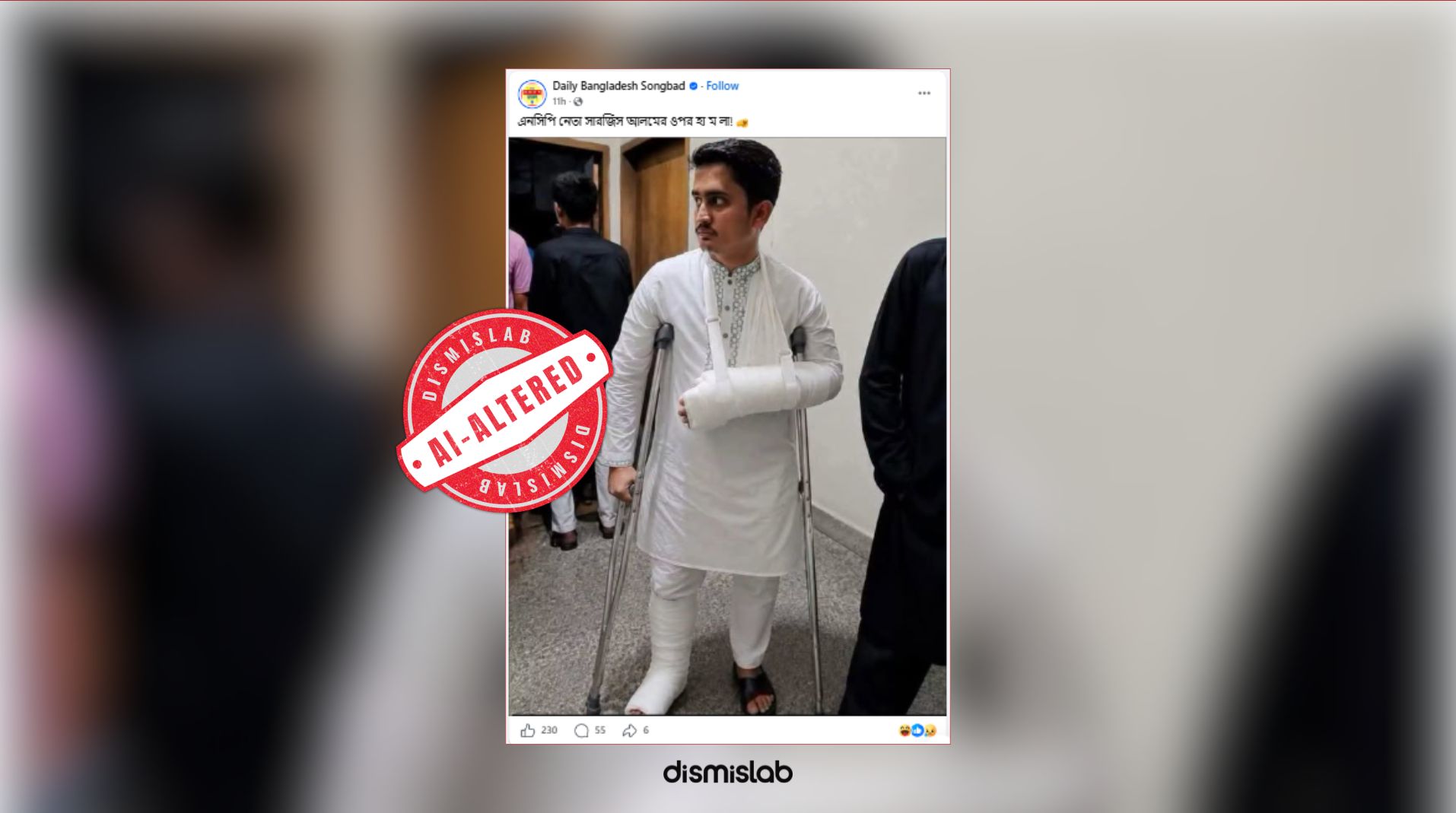 Photo of Sarjis Alam in bandages holding crutches is AI-edited